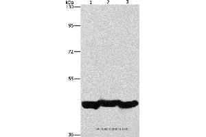 Western blot analysis of A549 cell and mouse liver tissue, hepG2 cell, using PGK1 Polyclonal Antibody at dilution of 1:1000