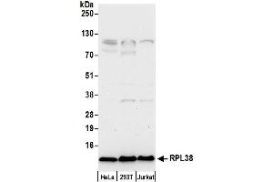 anti-Ribosomal Protein L38 (RPL38) (AA 20-70) antibody