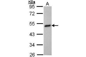 WB Image Sample (30 ug of whole cell lysate) A: Hep G2 , 10% SDS PAGE antibody diluted at 1:1000 (BHMT Antikörper)