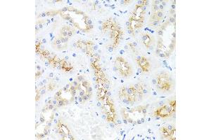 Immunohistochemistry of paraffin-embedded rat kidney using CXCL8 antibody (ABIN6290535) at dilution of 1:100 (40x lens). (IL-8 Antikörper)