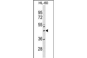 Western blot analysis in HL-60 cell line lysates (35ug/lane). (ZNF589 Antikörper  (AA 184-210))