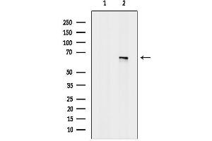 Western blot analysis of lysates from Rat lung, using VGLU Antibody.