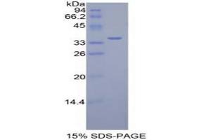 SDS-PAGE analysis of Mouse Dispatched Homolog 1 Protein.