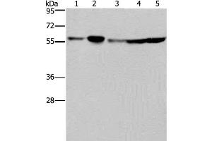 Western Blot analysis of Hela, 293T, A549, HT-29 and K562 cell using NUP50 Polyclonal Antibody at dilution of 1:200 (NUP50 Antikörper)