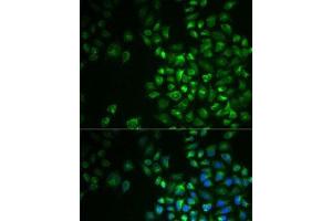 Immunofluorescence analysis of MCF7 cells using POLG2 Polyclonal Antibody (POLG2 Antikörper)