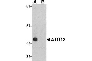 Western blot. (ATG12 Antikörper  (Middle Region))