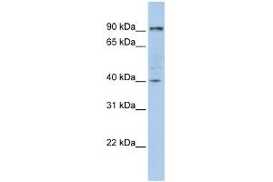 WB Suggested Anti-PYGB Antibody Titration:  0.