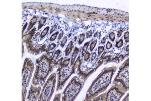 Immunohistochemistry (IHC) image for anti-Splicing Factor 1 (SF1) (AA 160-266) antibody (ABIN5692946)