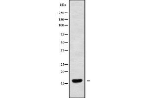 Western blot analysis of RPC9 using HuvEc whole cell lysates (CRCP Antikörper  (N-Term))