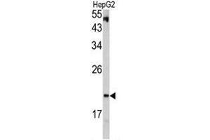 Western blot analysis of VHL antibody (C-term) in HepG2 cell line lysates (35ug/lane).