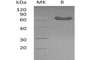 Western Blotting (WB) image for Lymphotoxin beta Receptor (TNFR Superfamily, Member 3) (LTBR) protein (Fc Tag) (ABIN7320611)