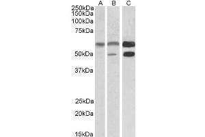 Western Blotting (WB) image for anti-Calcium/calmodulin-Dependent Protein Kinase II alpha (CAMK2A) antibody (ABIN5895999) (CAMK2A Antikörper)