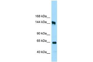 WB Suggested Anti-RRP12 Antibody Titration: 1.