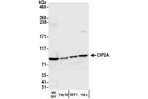 Western Blotting (WB) image for anti-KIAA1524 (KIAA1524) (AA 853-903) antibody (ABIN7453880) (KIAA1524 Antikörper  (AA 853-903))
