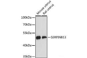 Western blot analysis of extracts of various cell lines using SERPINB13 Polyclonal Antibody at dilution of 1:3000. (SERPINB13 Antikörper)
