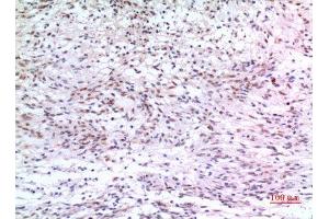 Immunohistochemistry (IHC) analysis of paraffin-embedded Human Brain, antibody was diluted at 1:100. (ZKSCAN4 Antikörper  (Internal Region))