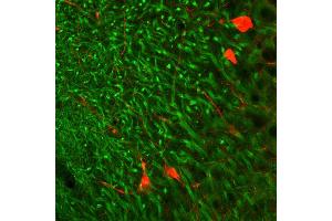 Indirect immunohystochemistry of a rat hippocampus section with anti-MAP 2 (dilution 1 : 500; green) and parvalbumin guinea pig antiserum (cat. (MAP2 Antikörper  (AA 2-309))