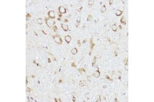 Immunohistochemistry of paraffin-embedded mouse spinal cord using NEURL1B Rabbit pAb (ABIN7268857) at dilution of 1:100 (40x lens). (NEURL1B Antikörper)