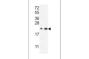 ABHEB Antibody (C-term) (ABIN653654 and ABIN2842995) western blot analysis in ,T47D cell line lysates (35 μg/lane). (ABHD14B Antikörper  (C-Term))