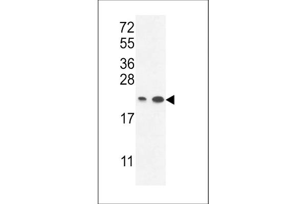 ABHD14B 抗体  (C-Term)