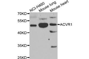 Western blot analysis of extracts of various cell lines, using ACVR1 antibody (ABIN5975601) at 1/1000 dilution. (ACVR1 Antikörper)
