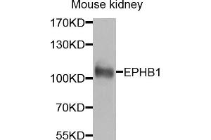 Western blot analysis of extracts of mouse kidney, using EPHB1 antibody (ABIN5974587) at 1/1000 dilution. (EPH Receptor B1 Antikörper)