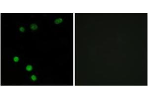 Immunofluorescence analysis of MCF7 cells, using TP53INP2 Antibody. (TP53INP2 Antikörper  (AA 1-50))