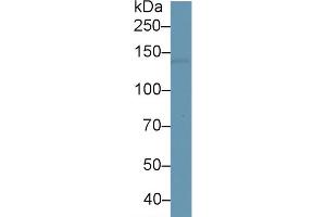 Rabbit Capture antibody from the kit in WB with Positive Control: Human brain tissue. (L1CAM ELISA Kit)