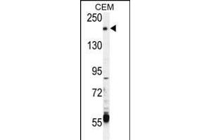 CHAK2 Antibody  (ABIN392616 and ABIN2842133) western blot analysis in CEM cell line lysates (35 μg/lane). (TRPM6 Antikörper  (AA 317-348))