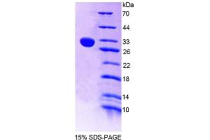 SDS-PAGE analysis of Mouse CHIT1 Protein. (Chitotriosidase 1 Protein)