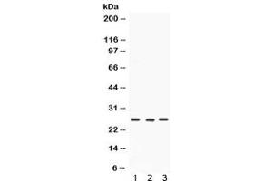 Western blot testing of 1) rat brain, 2) mouse testis and 3) human SW620 lysate with SIP antibody. (CACYBP Antikörper)