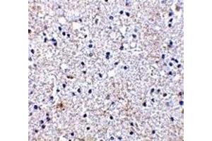 Immunohistochemistry (IHC) image for anti-SCO1 Cytochrome C Oxidase Assembly Protein (SCO1) (Middle Region) antibody (ABIN1031080) (SCO1 Antikörper  (Middle Region))