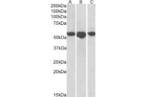 ABIN4902615 (1µg/ml) staining of Human Breast (A), Placenta (B) and Spleen (C) lysates (35µg protein in RIPA buffer). (SLC29A1 Antikörper)