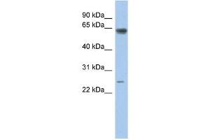 Western Blotting (WB) image for anti-TAF5-Like RNA Polymerase II, P300/CBP-Associated Factor (PCAF)-Associated Factor, 65kDa (TAF5L) (Middle Region) antibody (ABIN2779726)