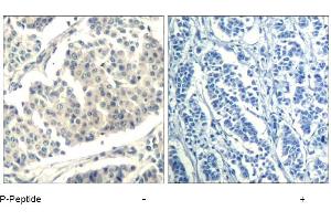 Image no. 1 for anti-Abelson Murine Leukemia Viral Oncogene Homolog 1/2 (ABL1/ABL2) (pTyr393), (pTyr439) antibody (ABIN319285) (ABL1/2 Antikörper  (pTyr393, pTyr439))
