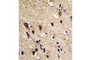 Immunohistochemical staining of formalin-fixed and paraffin-embedded human brain reacted with TUBB1 monoclonal antibody  at 1:10-1:50 dilution. (TUBB1 Antikörper)
