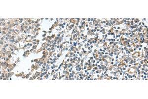 Immunohistochemistry of paraffin-embedded Human tonsil tissue using PAPSS2 Polyclonal Antibody at dilution of 1:95(x200) (PAPSS2 Antikörper)