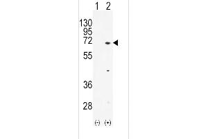 Western blot analysis of TXK (arrow) using rabbit polyclonal hTXK-E37 (ABIN392114 and ABIN2841863). (TXK Antikörper  (N-Term))
