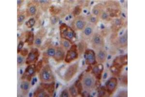 Used in DAB staining on fromalin fixed paraffin-embedded Liver tissue (COL18 Antikörper  (AA 1591-1774))