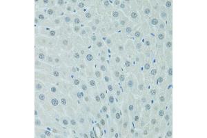 Immunohistochemistry of paraffin-embedded rat liver using CEBPA antibody (ABIN4903245) at dilution of 1:100 (40x lens).