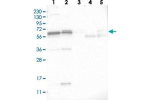 Western blot analysis of Lane 1: RT-4, Lane 2: U-251 MG, Lane 3: Human Plasma, Lane 4: Liver, Lane 5: Tonsil with C17orf70 polyclonal antibody  at 1:250-1:500 dilution. (C17orf70 Antikörper)