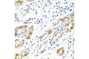 Immunohistochemistry of paraffin-embedded human stomach using BLVRB antibody at dilution of 1:100 (40x lens).