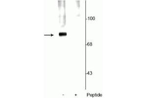 Western blot of rat cortical lysate showing specific labeling of the ~78 kDa synapsin protein phosphorylated at Ser62,67 in the first lane (-).