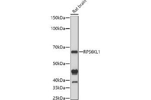 Western blot analysis of extracts of Rat brain cells, using RPS6KL1 antibody (ABIN6130681, ABIN6147242, ABIN6147243 and ABIN6223376) at 1:1000 dilution. (RPS6KL1 Antikörper  (AA 1-130))