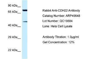 Western Blotting (WB) image for anti-Cadherin-Like 22 (CDH22) (N-Term) antibody (ABIN2783833) (CDH22 Antikörper  (N-Term))