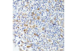 Immunohistochemistry of paraffin-embedded human appendix using TI antibody (ABIN6133213, ABIN6149144, ABIN6149145 and ABIN6221696) at dilution of 1:100 (40x lens).