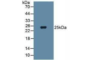 Detection of SOD3 in Human Blood Cells using Polyclonal Antibody to Superoxide Dismutase 3, Extracellular (SOD3) (SOD3 Antikörper  (AA 19-240))
