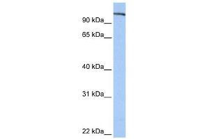 FES antibody used at 1 ug/ml to detect target protein.