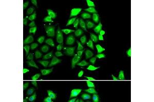 Immunofluorescence analysis of MCF-7 cells using IKZF3 Polyclonal Antibody (IKZF3 Antikörper)