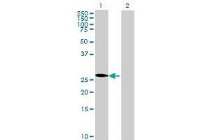 Lane 1: DUT transfected lysate ( 26. (DUT 293T Cell Transient Overexpression Lysate(Denatured))